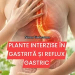 Plante interzise pentru gastrită reflux și impactul asupra simptomelor